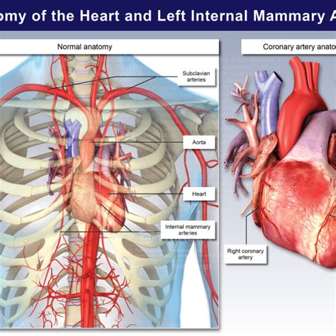 Anatomy of the Heart and Left Internal Mammary Artery - TrialExhibits Inc.