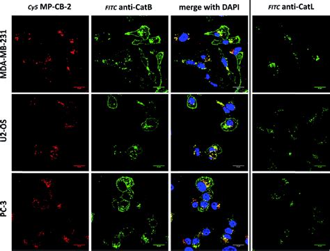 Cathepsin B detection in membranes and lysosomes of cancer cells ...