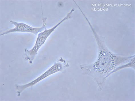 Fibroblast | Definition, Histology, & Function | Britannica