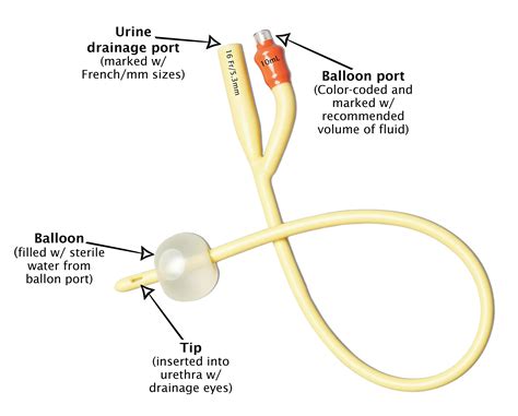 male catheters Archives - Personally Delivered Blog