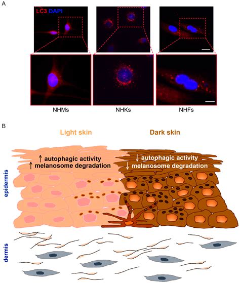 Cells | Free Full-Text | Shining Light on Autophagy in Skin ...