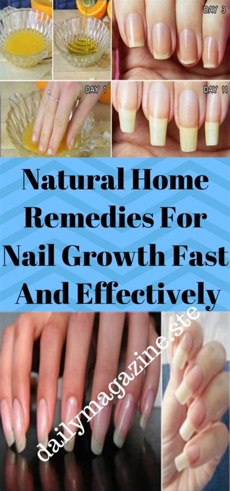 Home Remedies for Nail Growth (Fast & Naturally)