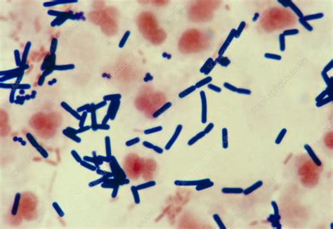 Clostridium perfringens bacteria from wound - Stock Image - B220/0201 - Science Photo Library