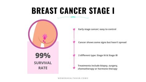 Everything About 5 Stages of Breast Cancer With Treatments