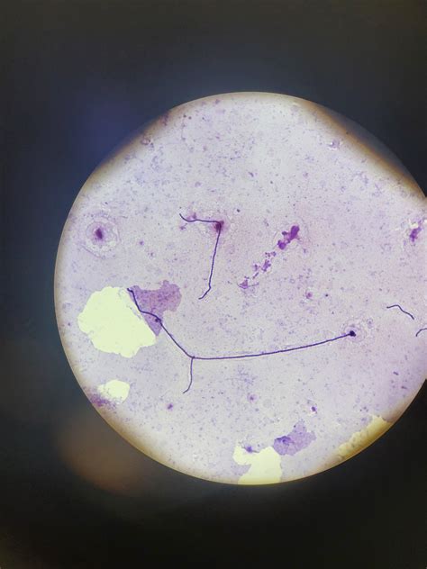 Streptococcus Salivarius Gram Stain