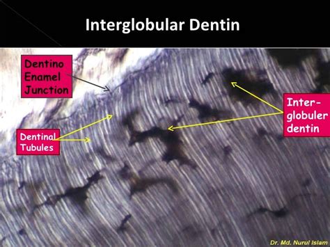 Histology of dentin