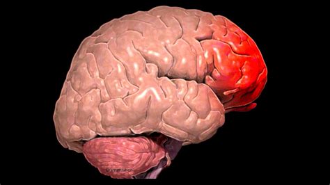 Frontal Lobe Traumatic Brain Injury - Injury Choices