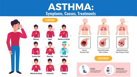 Asthma : 10 Easy Asthma Prevention Measures - Daily Medicos