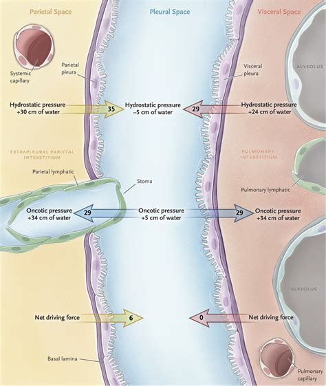 Pleural Effusion Pathophysiology