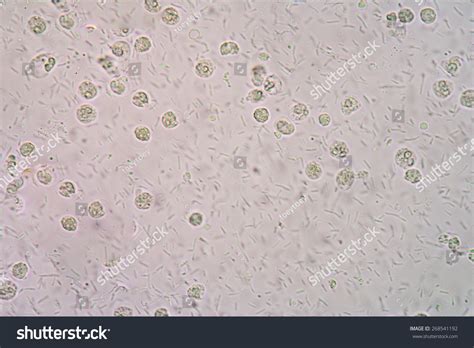 Urine Microscopic Bacteria