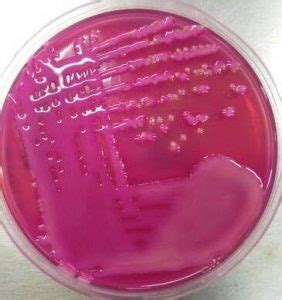 MacConkey Agar: Composition, Uses, Colony Characteristics