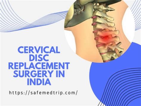 Cervical Disc Replacement Surgery Cost In India