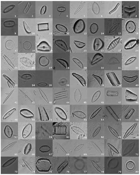 Applied Sciences | Free Full-Text | Automated Diatom Classification ...