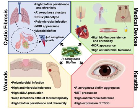 Pseudomonas aeruginosa biofilms and their partners in crime - Institute for Bioengineering of ...