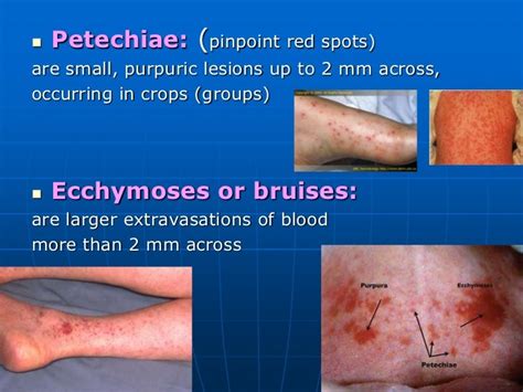 dermatology.1 eryth, telan, urt & hshp(dr.faraydwn)