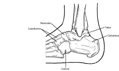 Seattle Tarsal Coalition Doctor - Seattle Foot and Ankle Center