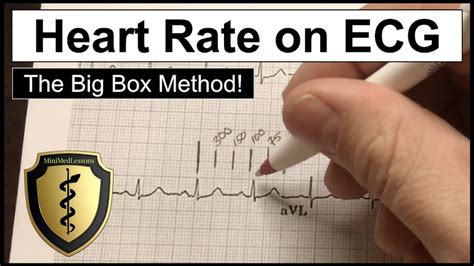 ECG Heart Rate Calculation - The Big Box Method (AKA the 300 Method ...