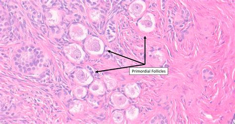 Primordial Follicle Labeled