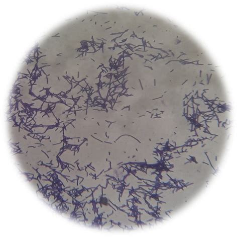 Microscopic observation of Gram's stained Lactobacillus spp. | Download Scientific Diagram