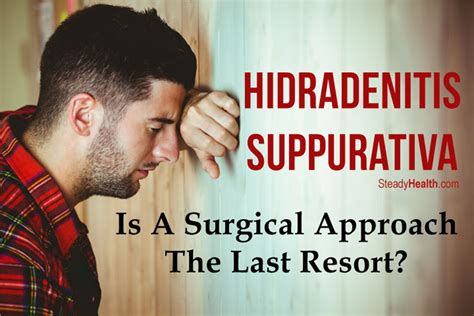 Hidradenitis Suppurativa Treatment With Surgery: Is A Surgical Approach ...