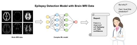 How Explainable Artificial Intelligence (XAI) Can Help Us Trust AI | by ...