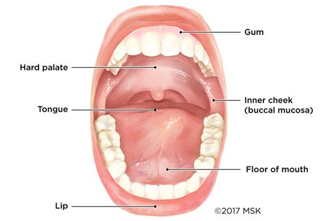 Mouth (Oral) Cancer | Memorial Sloan Kettering Cancer Center