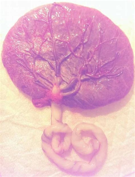 Beautiful placenta. Tree of life