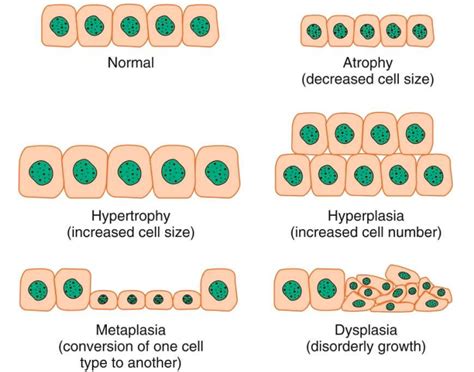 Cellular Adaptation Table Diagram | Quizlet