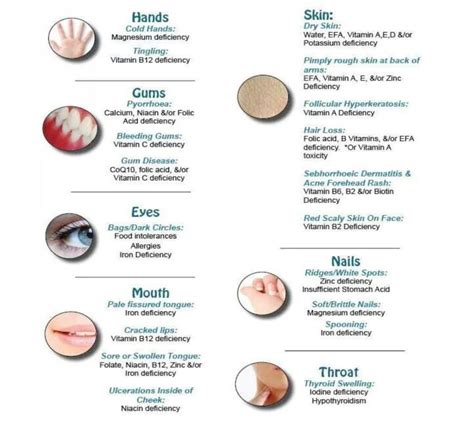 Symptoms of vitamin and mineral deficiency | Cryojuvenate UK ...