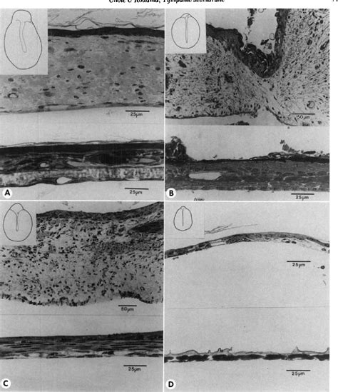 Figure 3 from Comparative Histology of the Tympanic Membrane and its ...