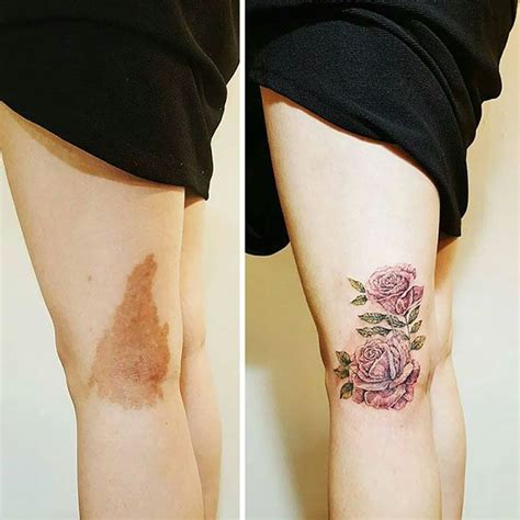 22+ Jojo Birthmark Tattoo - MichaelCorbyn