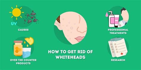 How to Get Rid of Whiteheads (Forever) - Skincare Hero