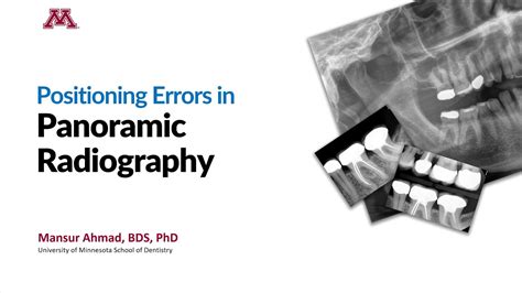 Positioning Errors in Panoramic Radiography - YouTube