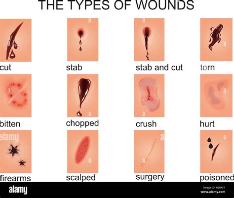 Torn wounds Stock Vector Images - Alamy