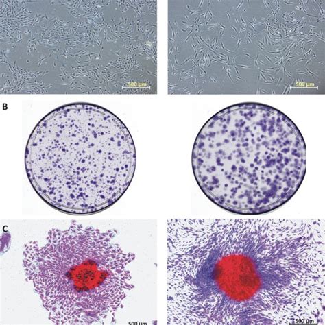 Multi-differentiation potential of PDL cells (visual examination) a PDL ...