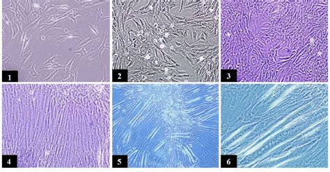 Microscopic images of C2C12 culture and differentiation steps.... | Download Scientific Diagram