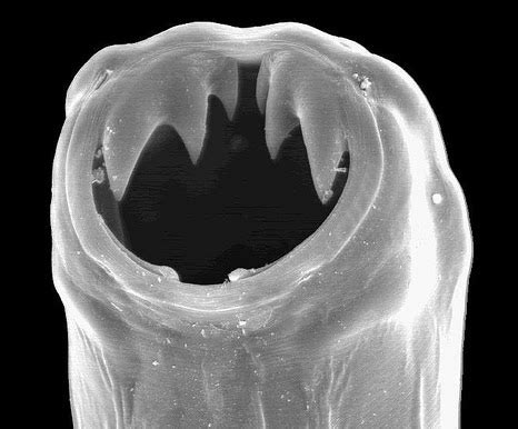 Infection Landscapes: Hookworm