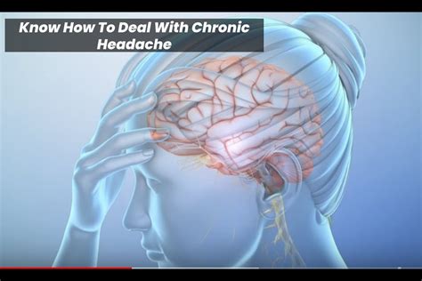 Know How To Deal With Chronic Headache - Everyday Health Life