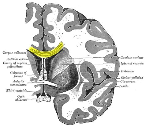 Split brains reconnect via alternate routes | Human World | EarthSky