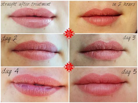 Perfect 15 Pics Semi Permanent Makeup Lips Aftercare And Description