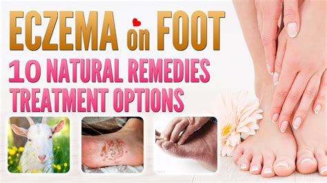 Eczema on Foot Treatment 10 Best Natural Home Remedies Treatment ...