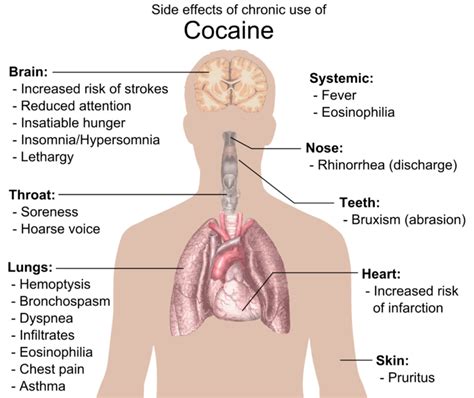 Behavioural Sciences: M05.05.07 Cocaine Abuse