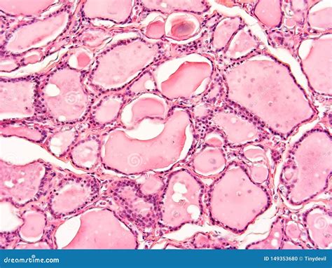 Histology of Human Thyroid Gland Tissue Stock Photo - Image of microscope, cell: 149353680