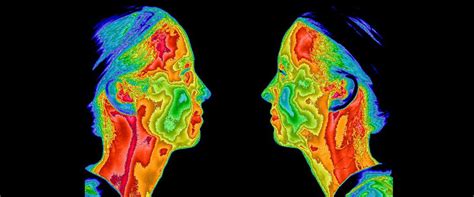 Medical Infrared Imaging – IACT