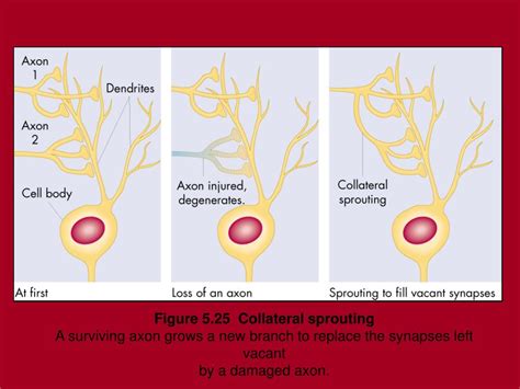 PPT - Stroke Nursing Rehab PowerPoint Presentation, free download - ID ...