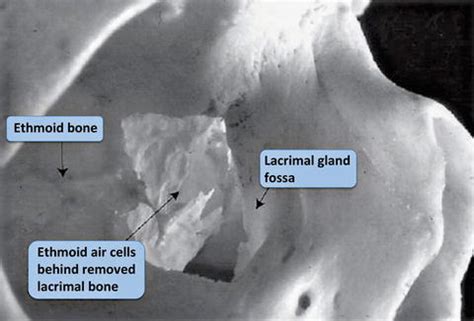 Anatomy of the Lacrimal System | Ento Key