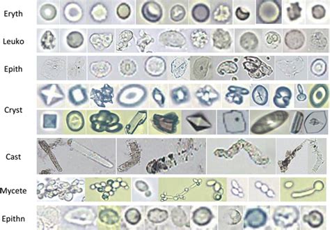 Urine Microscopy Labeled