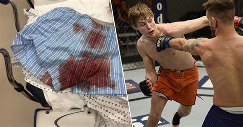 UFC Fighter Suffers Injury to Balls and Conor McGregor is Laughing