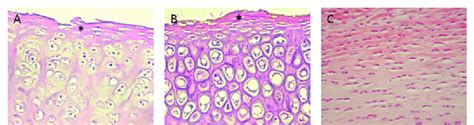 Cartilage Tissue Types