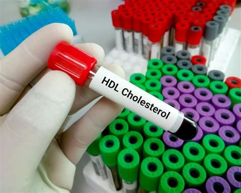 Premium Photo | Blood sample for HDL Cholesterol test or HDL C or good ...